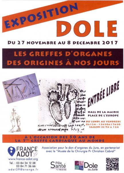 Expo a dole